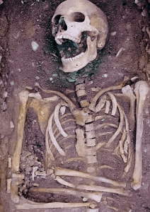 Bones